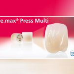 IPS e.max Press Multi