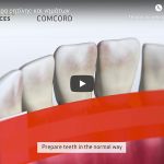 Νέο Προϊόν από την DNN Dental: COMCORD, Μήτρα ρητίνης και νημάτων