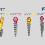 RHEIN83: Εξαρτήματα κινητής και ακίνητης προσθετικής για τα Roott Implants κι όχι μόνο