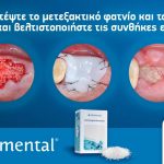 Ariston Dental - Elemental: Προστατέψτε το μεταξακτικό φατνίο και το οστικό μόσχευμα και βελτιστοποιήστε τις συνθήκες επούλωσης