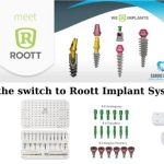 Ξεκινήστε χωρίς κόστος με το σύστημα εμφυτευμάτων της Roott