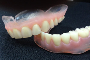 Ολικές οδοντοστοιχίες  με διάφανη βάση ή με διάφανη υπερώα